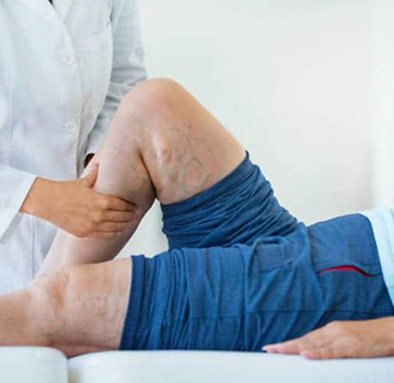 A clinician conducting a vein consultation — Lowcountry Vein Specialists, Murrells Inlet SC.